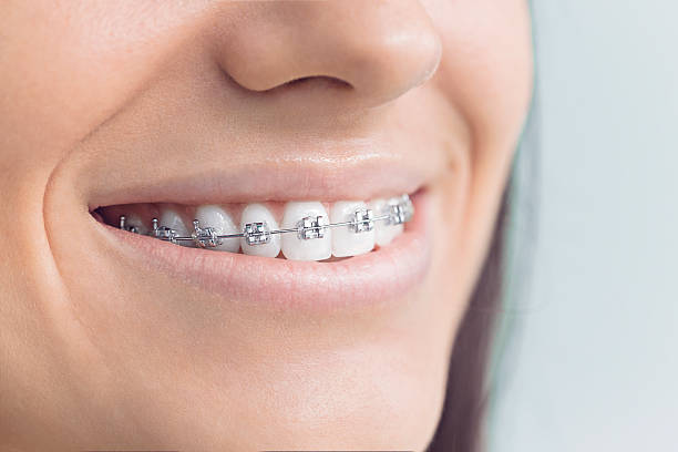 Why Choose Us for Your Dental Needs in Centerville, CA